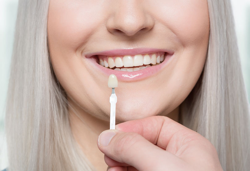 dental patient getting fitted for porcelain veneers Leesburg, VA